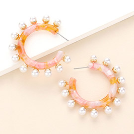 Peal Embellished Acetate Hoop Earrings